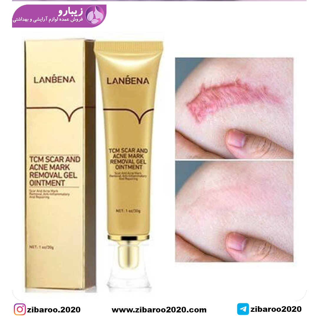 ژل کرم درمان جای جوش صورت و آکنه و اسکار لانبنا – Lanbena Tcm Scar And Acne Mark - Image 5