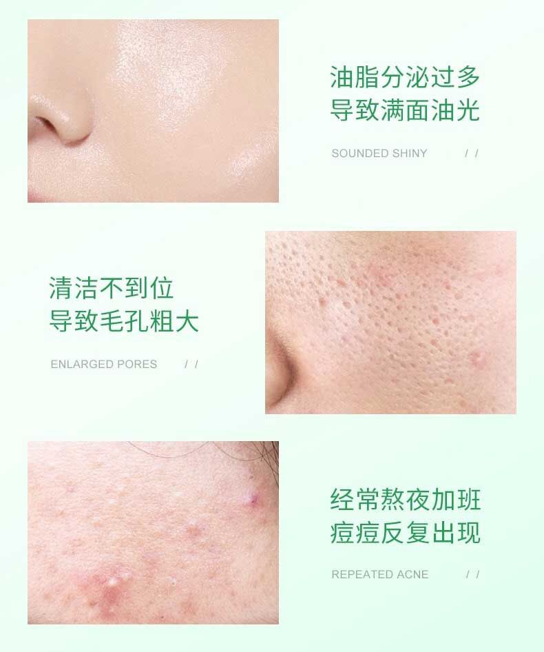 پد ضدجوش سالیسیلیک اسید بیوآکوا - Image 4