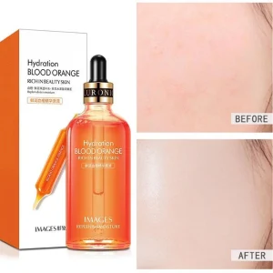 سرم پرتغال خونی ایمیجز