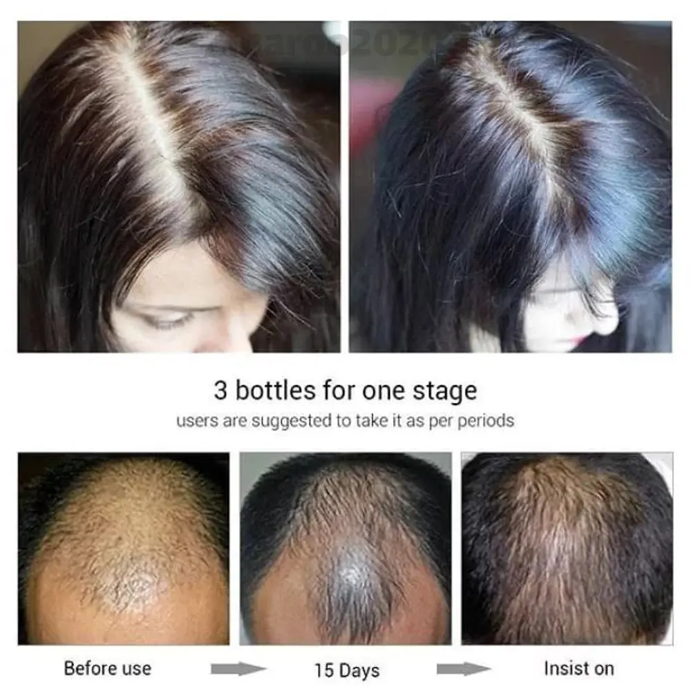 اسپری محرک رشد و ضدریزش مو لانبنا - Image 5